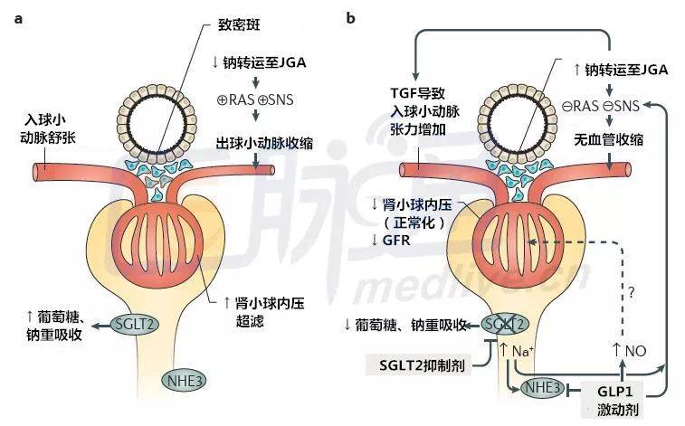 2017肾病最新消息,2020年肾病突破